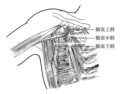 腋下流血|腋下淋巴结有血流信号怎么回事